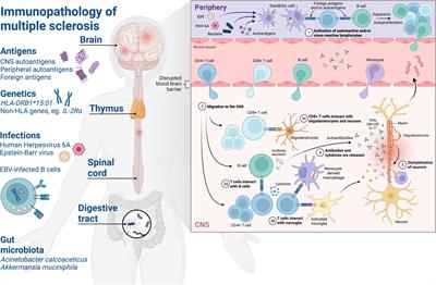 Mimicking the brain: Epstein-Barr virus and foreign agents as drivers of neuroimmune attack in multiple sclerosis